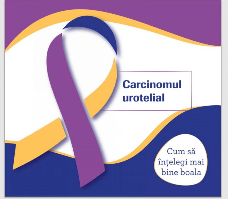 Imunoterapie oncologică compensată pentru românii care suferă de cancer de vezică urinară 