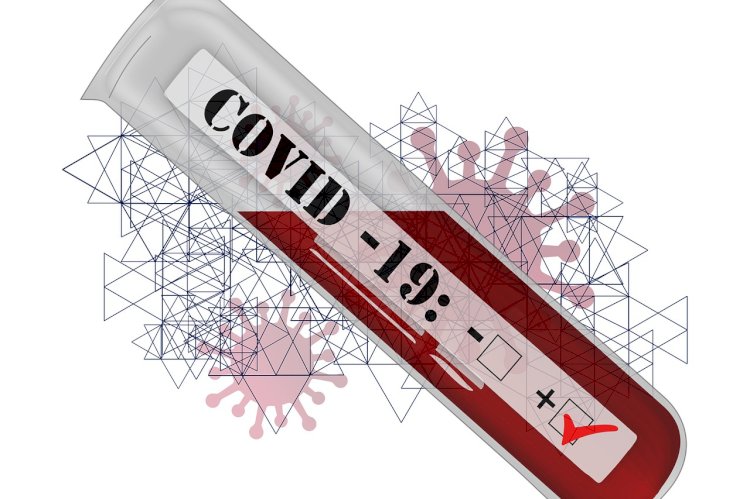 Test de antigen rapid pentru screening asimptomatic în COVID-19 și recoltare autoadministrată 