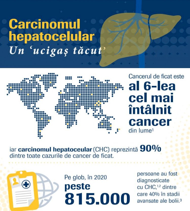 Imunoterapie disponibilă în România pentru pacienții cu cea mai frecventă formă de cancer de ficat